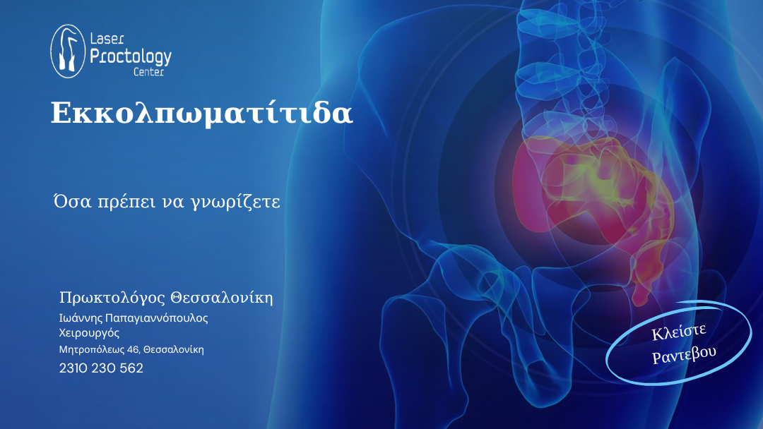 Εκκολπωματίτιδα